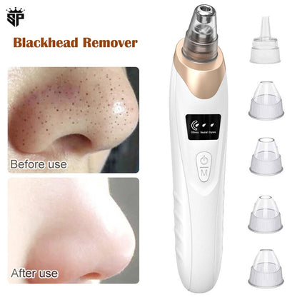 Blackhead Remover