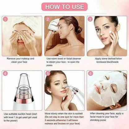 Blackhead Remover