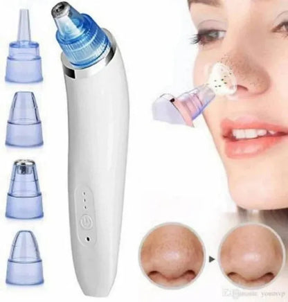 Blackhead Remover