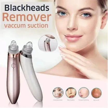 Blackhead Remover